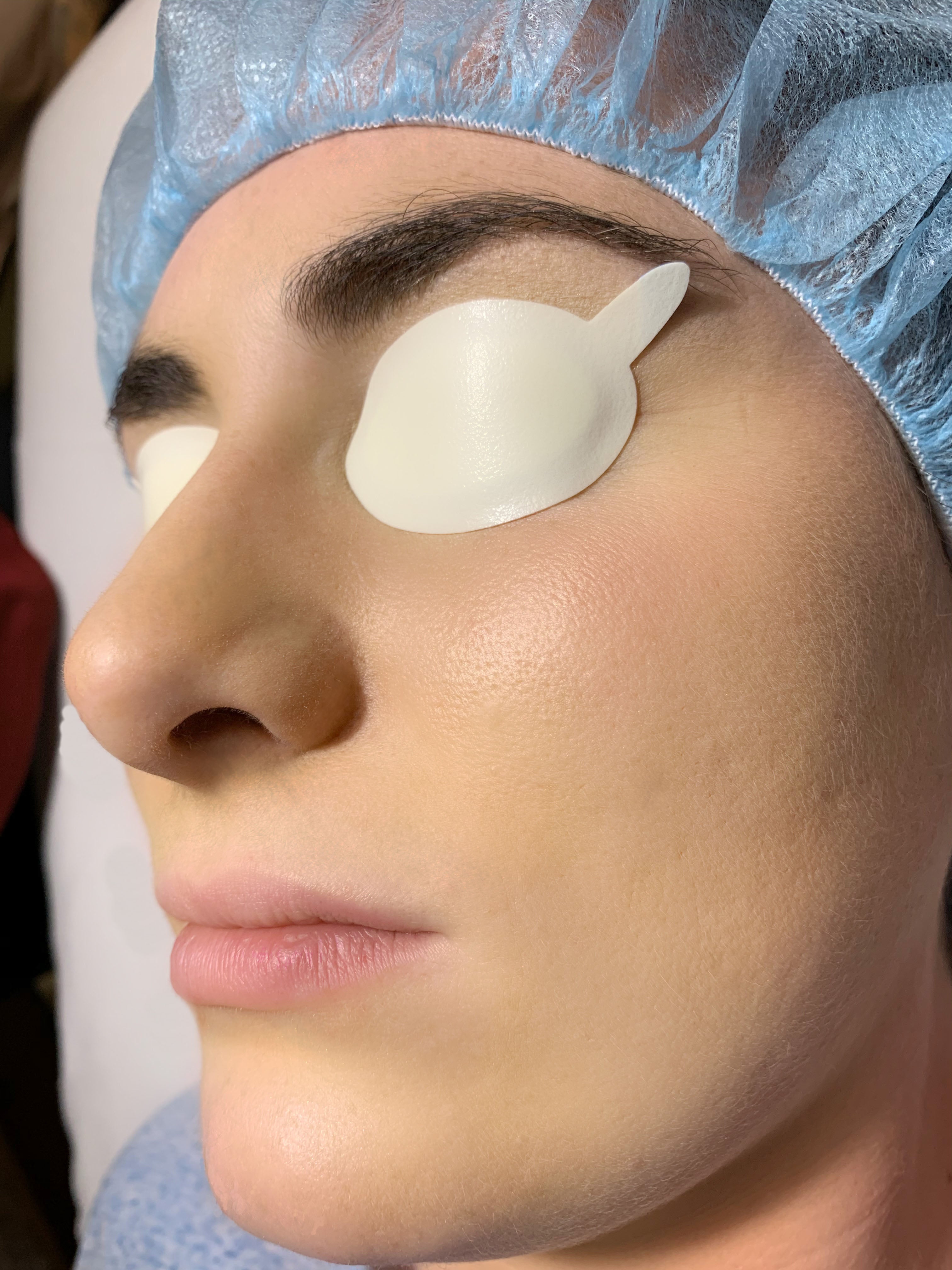Theia Eye Block TT73 IPL Non-Laser Eye Shield, 50 Pairs/Box