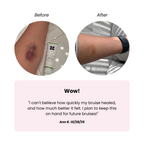 BIOCORNEUM® Advanced Bruise Cream