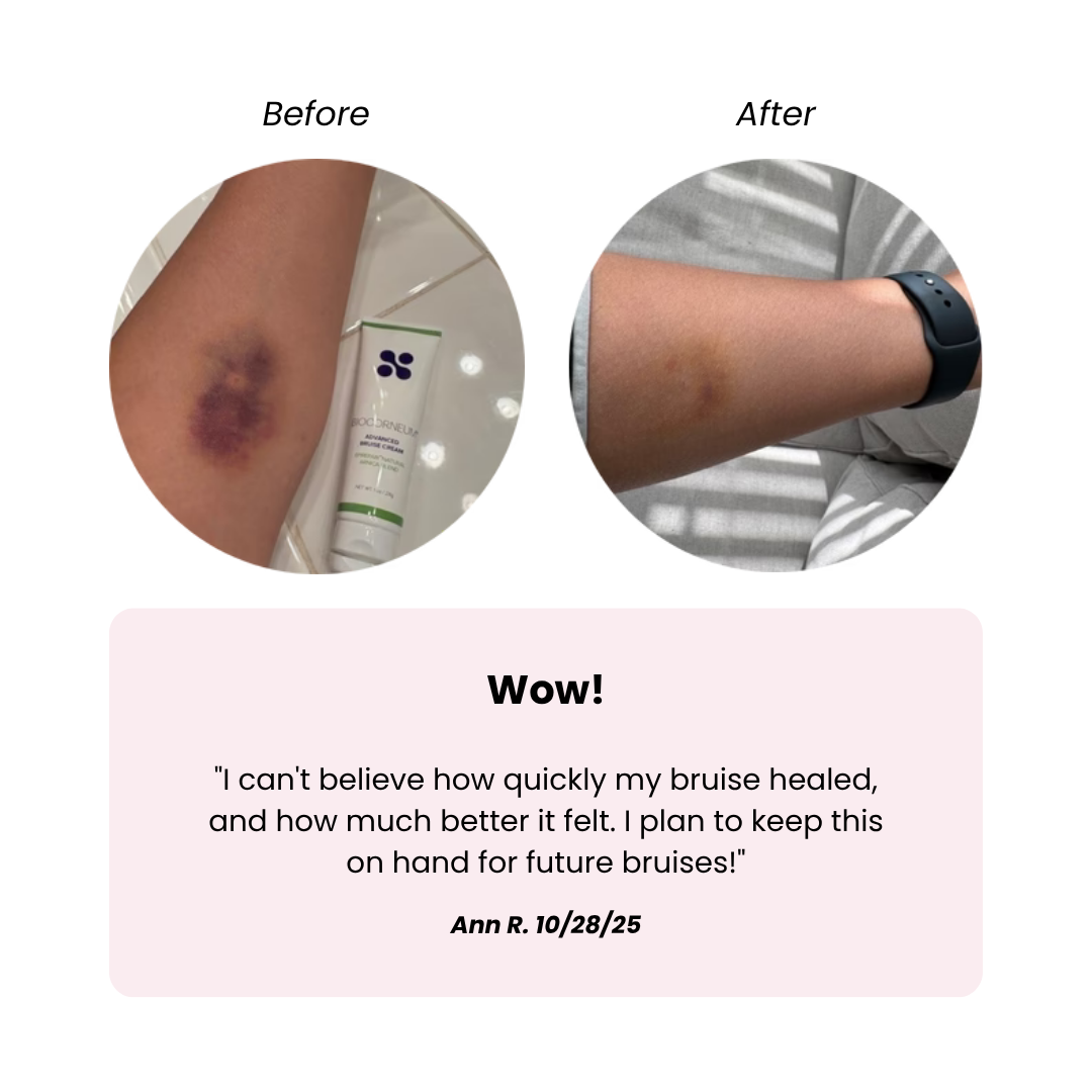 BIOCORNEUM® Advanced Bruise Dietary Supplement