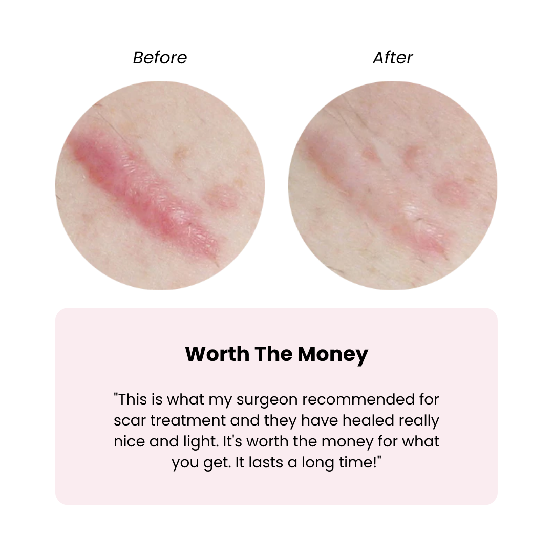 BIOCORNEUM® SiliShield Advanced Scar Gel with SPF 30